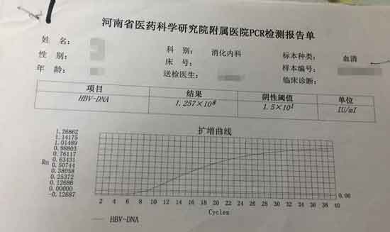 郑州治疗乙肝医院那个肝病医院好