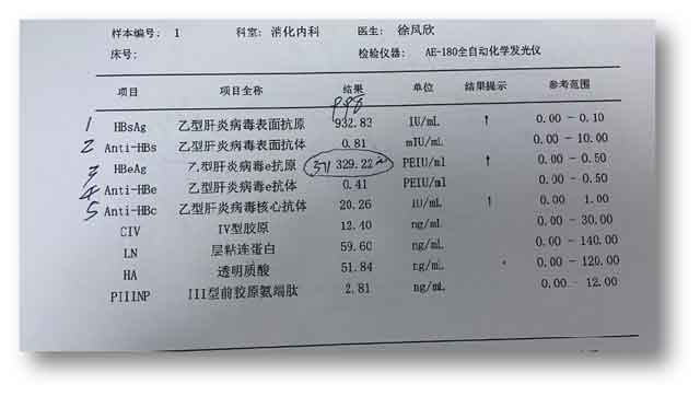 郑州哪家肝病医院治疗乙肝效果比较好