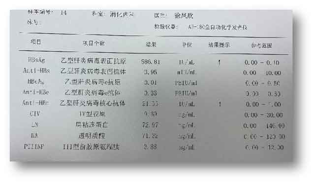 郑州哪家肝病医院治疗乙肝效果比较好
