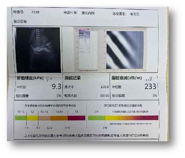 郑州哪家肝病医院治疗乙肝效果比较好