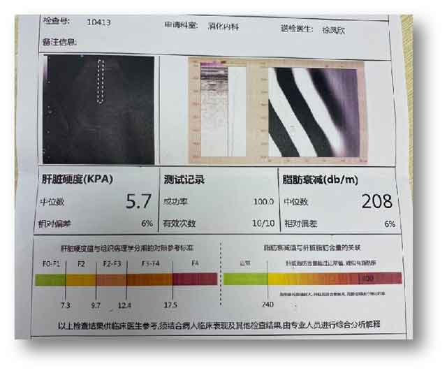 郑州哪家肝病医院治疗乙肝效果比较好