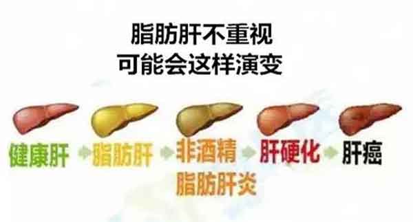 郑州有治疗肝病的医院吗?郑州肝病哪个好