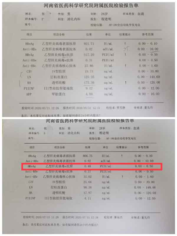 郑州市哪家医院看大三阳比较好